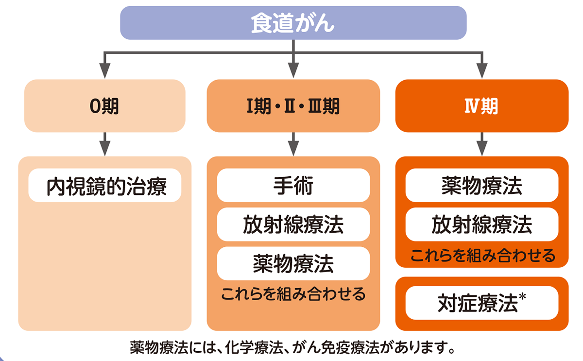 食道がんの治療法