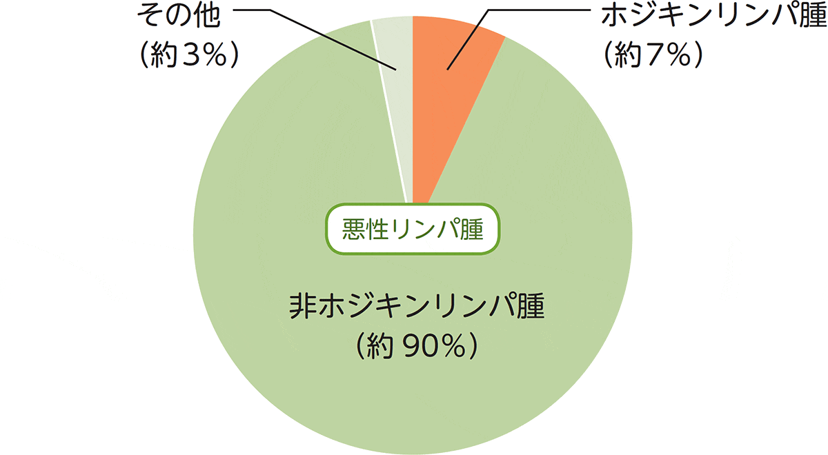 日本における悪性リンパ腫の発症割合のグラフ。悪性リンパ腫のうち、約90％が非ホジキンリンパ腫、約7％がホジキンリンパ腫の割合です。