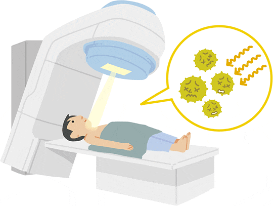 放射線療法を受ける患者さんのイラスト