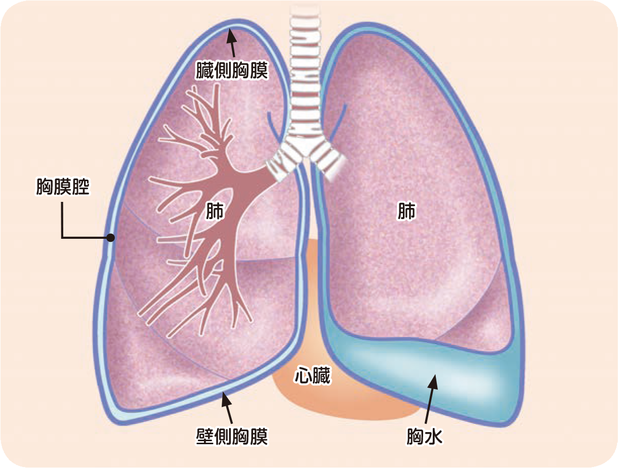 胸膜の位置と構造