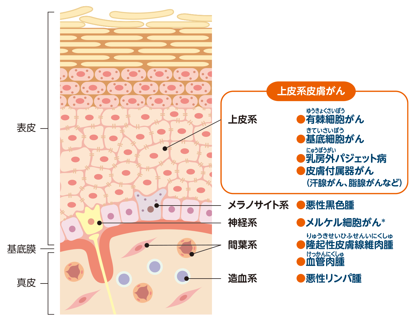 皮膚の構造と主な皮膚がん