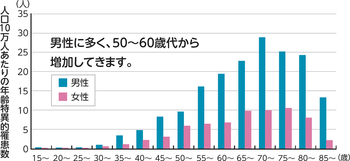 腎細胞がんの、人口10万人あたりの年齢特異的罹患数のグラフ。日本における腎細胞がんは男性に多く、50代60代から増加し70歳代前半が最も多いです。