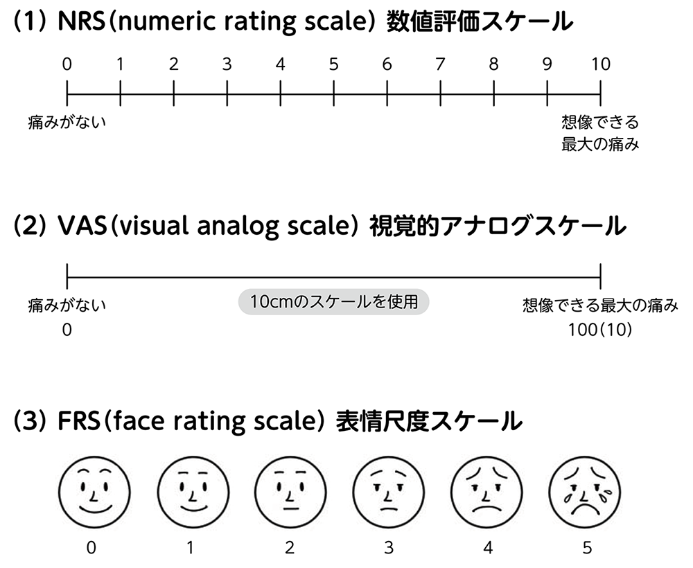 （１）NRS数値評価スケール、（２）VAS視覚的アナログスケール、（３）FRS表情尺度スケール